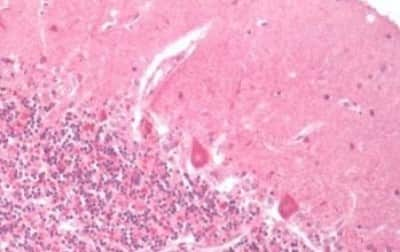 Immunohistochemistry-Paraffin: PTH2R Antibody [NBP3-14453]